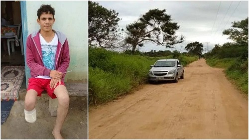 Justiça concluiu que servidor da UFRB simulou assalto e mutilação para obter indenizações por invalidez