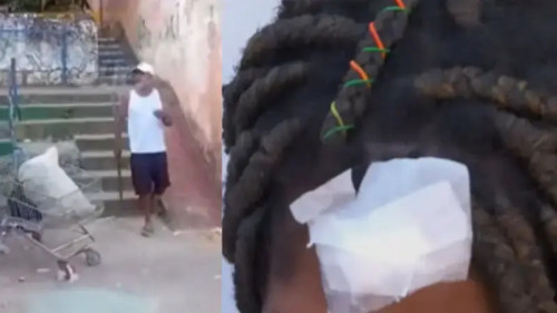 Grávida é agredida com barra de ferro por vizinho após discussão por causa de pão